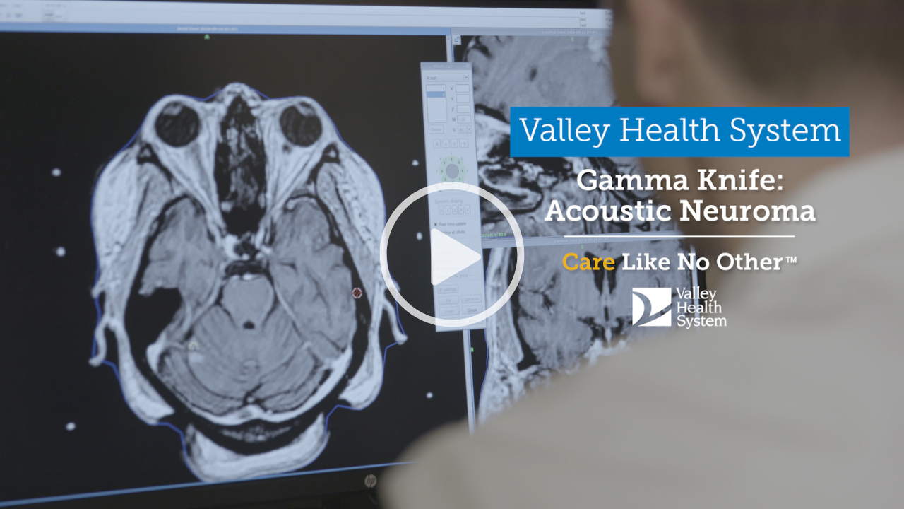 GK Acoustic Neuroma