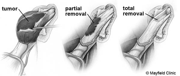 Fig4Removal600