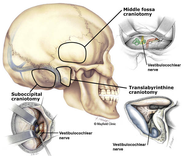 Fig5Surgery600